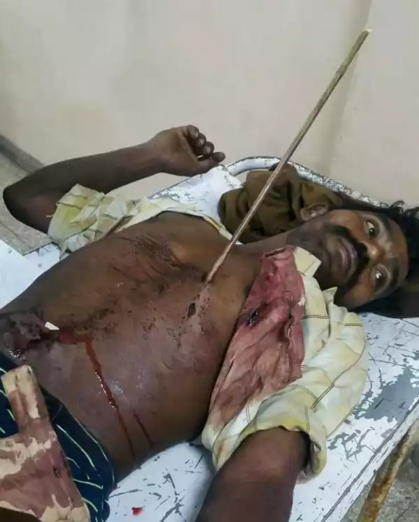 Man Shot In The Chest With An Arrow After Quarrel With His Family. Graphic Pics